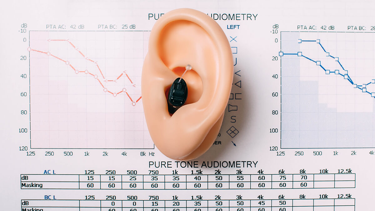 Audiogram with Hearing Aid and Ear Model